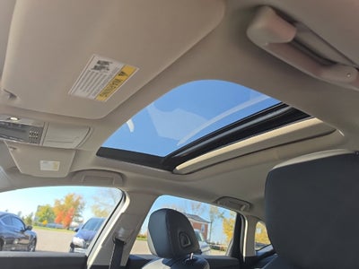 2025 Acura TLX Technology Package
