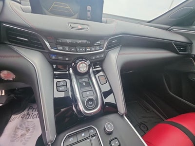 2025 Acura TLX A-Spec Package SH-AWD